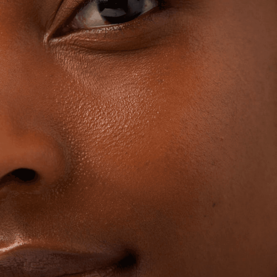 What is the Skin Barrier?